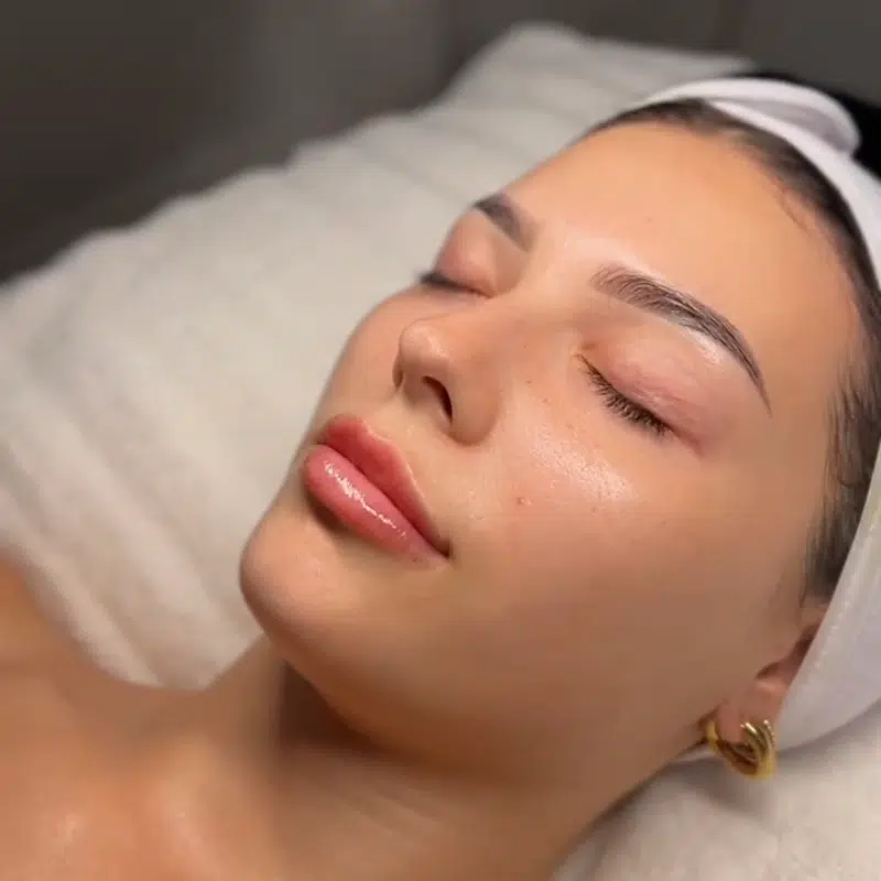 Skin lightening drips (IV therapy