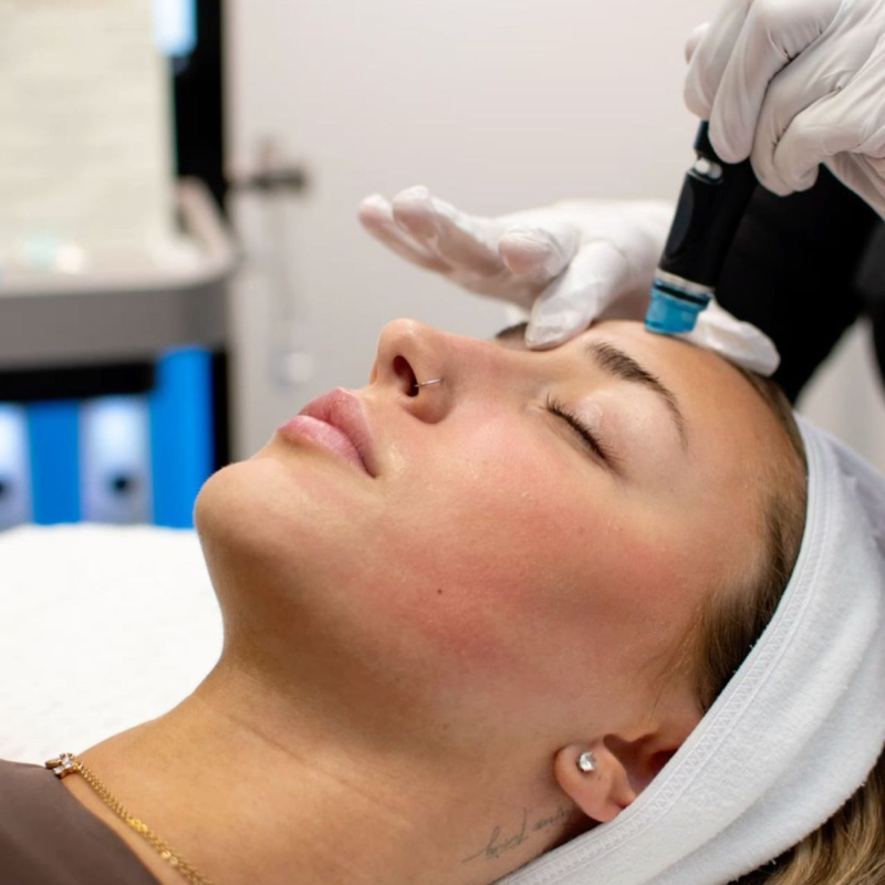 Hydrafacial