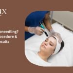 What Is Microneedling