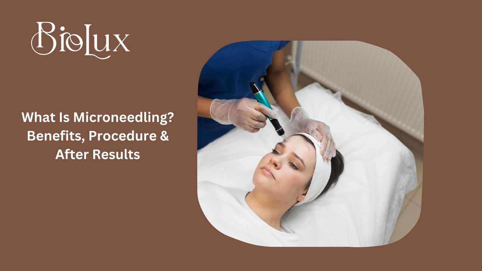 What Is Microneedling